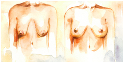 Breast Lift Treatment in Coimbatore