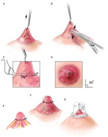Plastic Surgery in Coimbatore