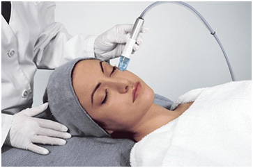 Dermabrasion in Coimbatore