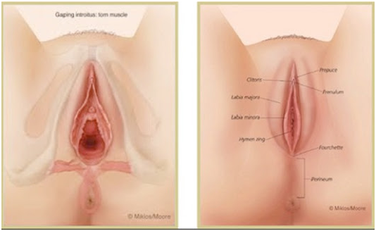 Cosmetic Surgeon in Coimbatore