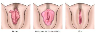 Plastic Surgeon in Coimbatore