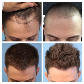 Plastic Surgeon Near Me