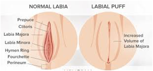 Plastic Surgery in Coimbatore