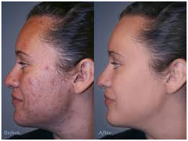 Plastic Surgeon in Coimbatore