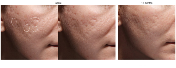 Scar Management in Coimbatore