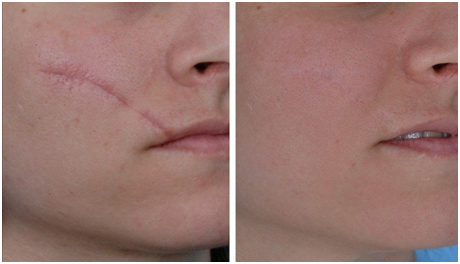 Plastic Surgery in Coimbatore