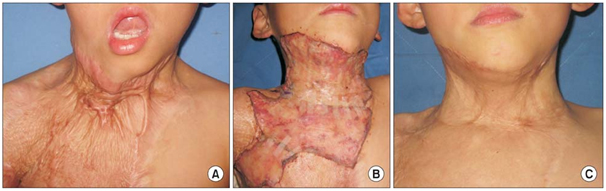 Cosmetic Surgery in Coimbatore